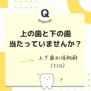 上の歯と下の歯、当たっていませんか?上下歯列接触癖(TCH)